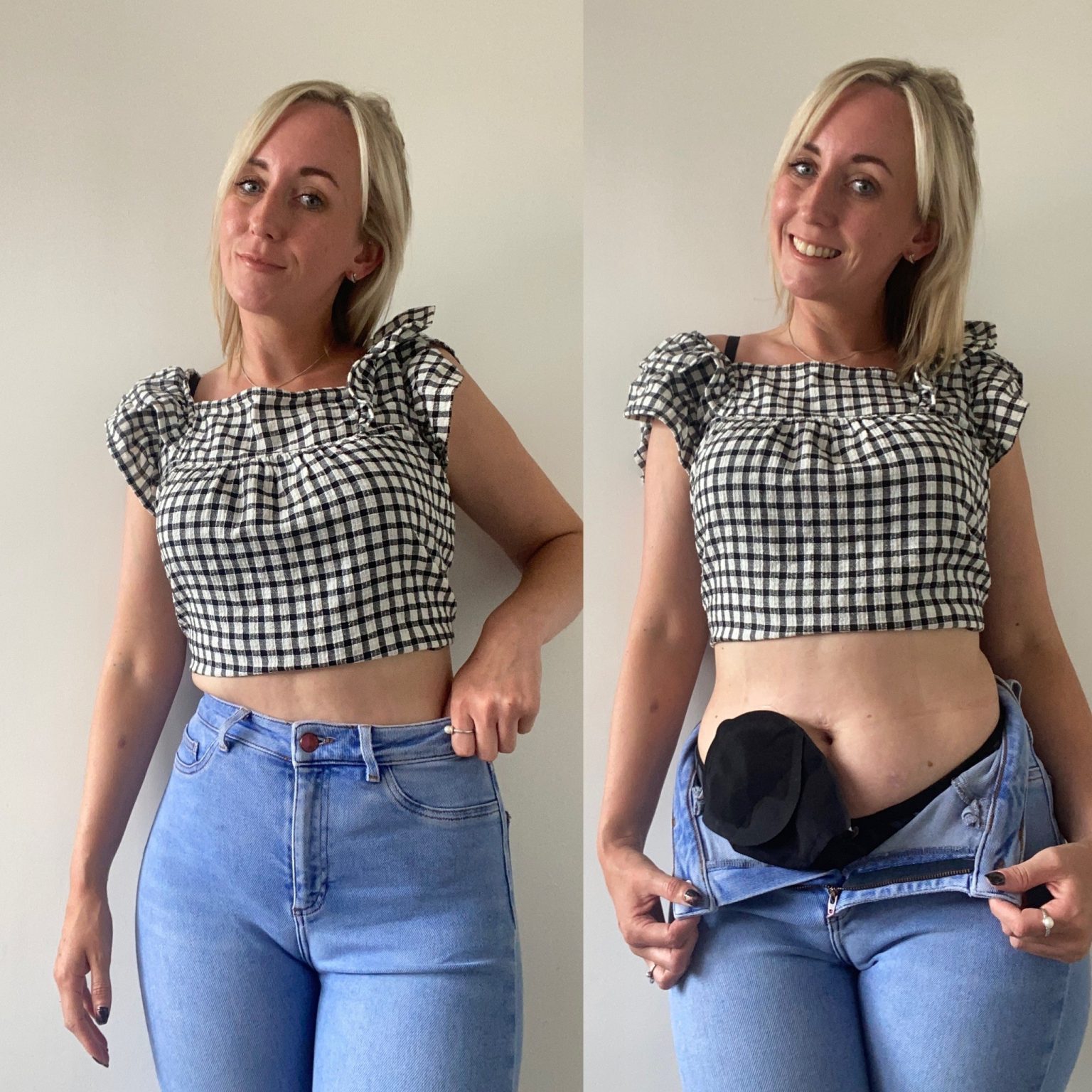 Womens Summer Fashion With A Stoma Pelican Healthcare